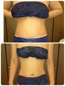 大阪府泉大津市の美痩身サイズダウンダイエット♪「サロンドロ－ズ」１１月最新ご予約状況☆